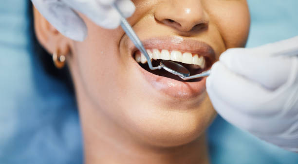 Best Emergency Dental Care for Broken or Chipped Teeth in Augusta, WI